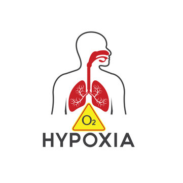illustration of hypoxia, oxygen levels in cells or body tissues decrease.