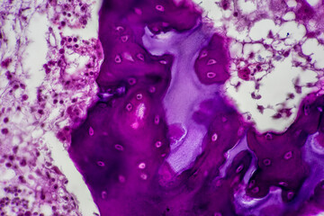 Tissue sample of Bone human, Elastic cartilage human and Red bone marrow under the microscope in Lab.