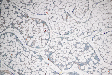 Tissue sample of Bone human, Elastic cartilage human and Red bone marrow under the microscope in...