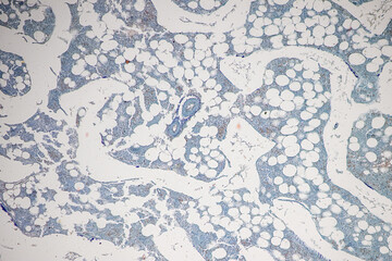 Tissue sample of Bone human, Elastic cartilage human and Red bone marrow under the microscope in Lab.