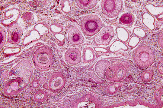 Tissue sample of Bone human, Elastic cartilage human and Red bone marrow under the microscope in Lab.