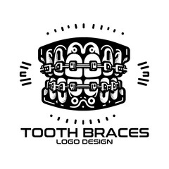 Tooth Braces Vector Logo Design