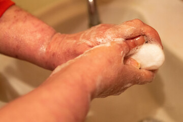 Woman washes her hands with soap under a stream of water. Covid19 concept