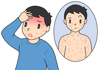 病気・疾病のイラスト - 大人のはしか・麻疹・発疹・発熱