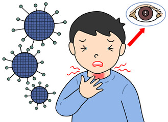 病気・疾病のイラスト - アデノウイルス感染症・咽頭炎・目やに・子供