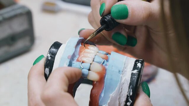 A dental technician works with hot molten wax to make a denture. Close-up.