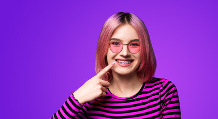 Dental dent care ad concept image - pink funny woman girl in metal braces wear sunglasses eye glasses, stripes long sleeve shirt pointing white teeth smile. Isolated violet purple background