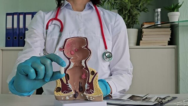 Soft suppository with laxative medicine or for treatment of proctological diseases concept
