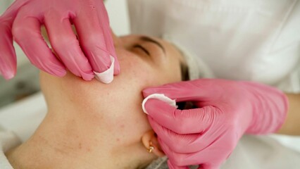 Before the ultrasonic facial cleansing procedure, a professional cosmetologist applies a film to...