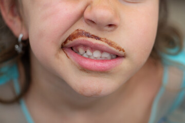 Fototapeta premium Mouth of a Caucasian girl grimacing and chocolate-stained mustache. Close-up photo. Sugary foods in children's diets.