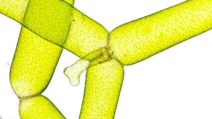 The water net (Hydrodictyon sp) under microscope. Collected from paddy fields in Indonesia. 