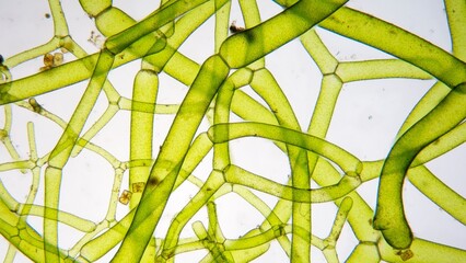 The water net (Hydrodictyon sp) under microscope. Collected from paddy fields in Indonesia. 