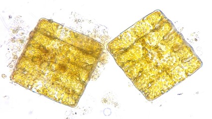 Terpsinoe sp, a microalgae belonging to diatom group. Colected from paddy fields in Indonesia. 400x magnification + 2.6x camera zoom. Stacked photo