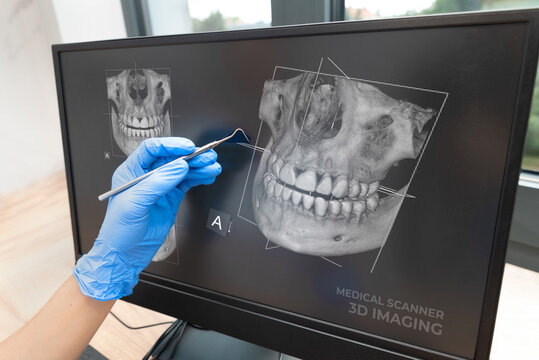 Dental consultation with 3D tomography image