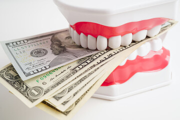 Treatment dental care cost, dental expense or fee, US dollar banknote money with teeth model.