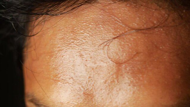 closeup of sweat on forehead against dark background ,