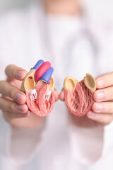 Doctor hold human Heart anatomy model. Cardiovascular Diseases, Atherosclerosis, Hypertensive...