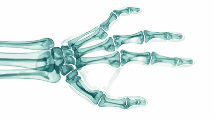Radiograph X-radiation picture or X-ray image of hand