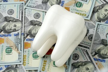 Concept expensive dentistry or dental insurance. Tooth model and money bills background
