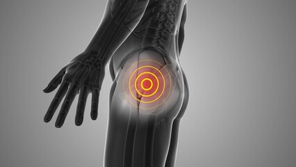 Hip discomfort that triggers pain