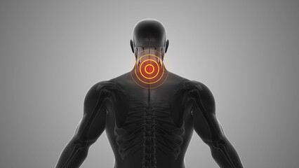 Lower neck discomfort that triggers pain
