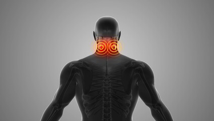 Neck discomfort that triggers pain