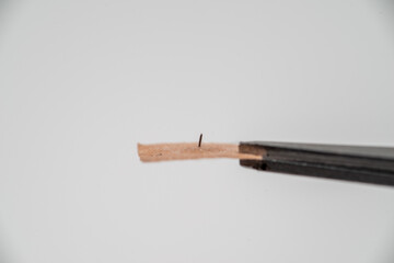 Auriculotherapy (also auricular therapy, ear acupuncture, and auriculoacupuncture) is a form of alternative medicine