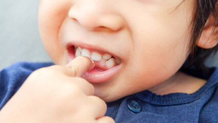 closeup Asian toddler points his teeth with finger