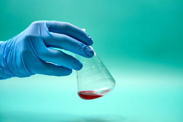 Hand of anonymous doctor in latex glove holding conical flask with red chemical sample in laboratory during diagnostic test