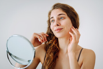 Portrait of a young woman without makeup with Acne skin. Natural beauty. Medical care and treatment...