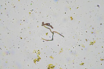 soil microorganisms in a soil life sample from a sustainable agriculture farm. living food web or...