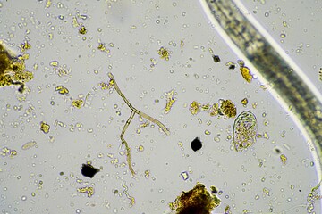soil microorganisms in a soil life sample from a sustainable agriculture farm. living food web or...