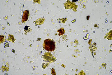 fungal hyphae and soil fungi in a soil sample, showing the living soil form a farm