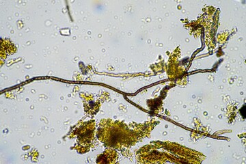 fungal hyphae and soil fungi in a soil sample, showing the living soil form a farm