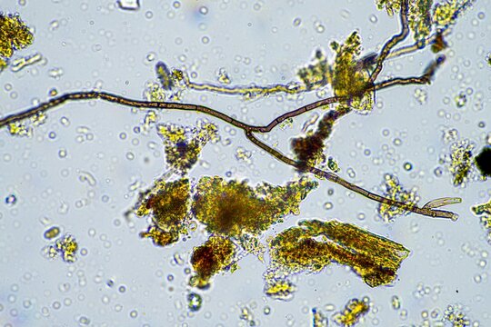 soil microorganisms in a soil life sample from a sustainable agriculture farm. living food web or bacteria fungi and protozoa