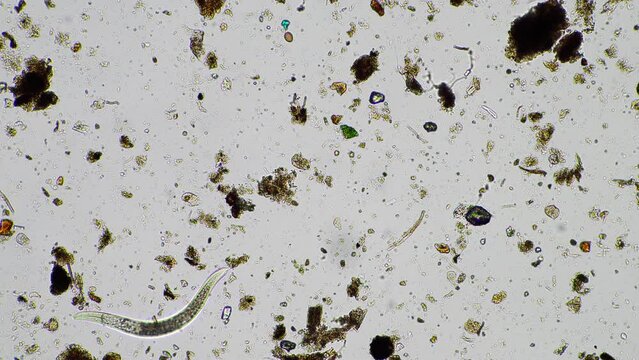 soil microorganisms in a soil life sample from a sustainable agriculture farm. living food web or bacteria fungi and protozoa
