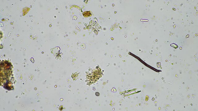 human parasite. gut intestinal infection disease. microorganism infection in hospital