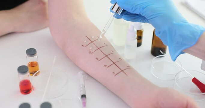 Allergy test skin prick test for possible allergens