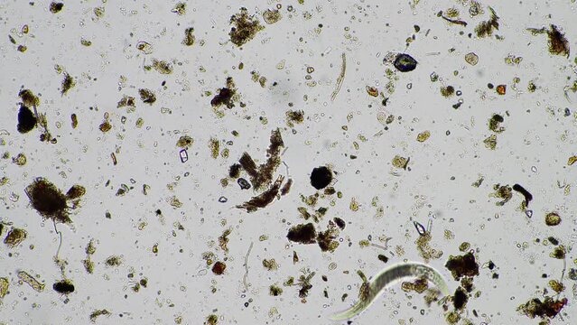 soil microorganisms in a soil life sample from a sustainable agriculture farm. living food web or bacteria fungi and protozoa