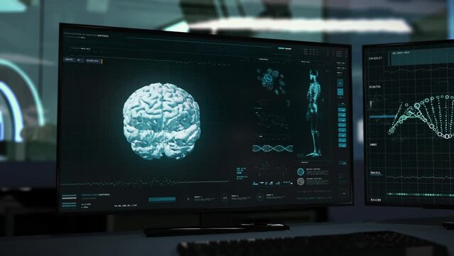 Health monitoring system is analyzing the patients brain at the hospital. Medical software deals with brain health monitoring process. Health monitoring tech identifies the deadly tumor in the brain