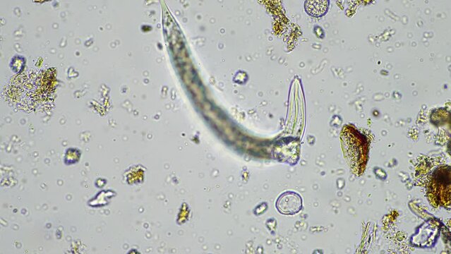 human parasite. gut intestinal infection disease. microorganism infection in hospital