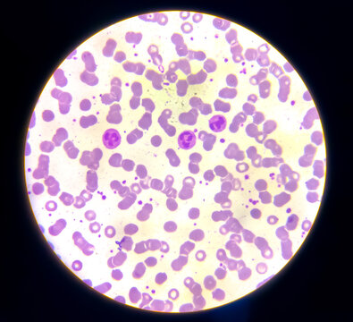 Giant platelets, Neutrophils and Red blood cells (RBC) analysed by light microscope