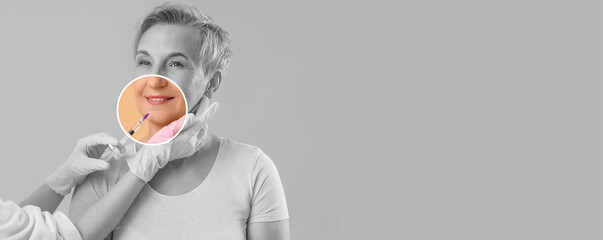 Mature woman receiving lip filler injection on beige background