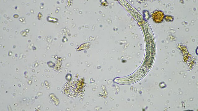 soil microorganisms in a soil life sample from a sustainable agriculture farm. living food web or bacteria fungi and protozoa