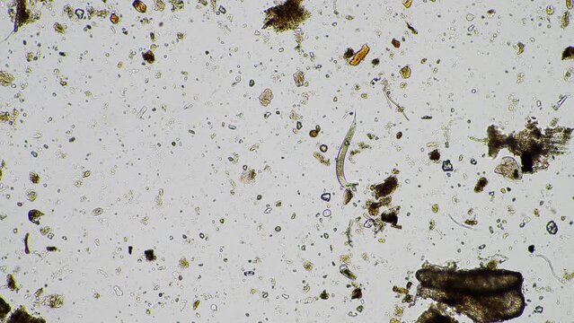 human parasite. gut intestinal infection disease. microorganism infection in hospital