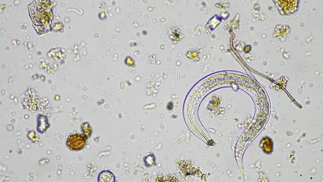 microorganisms and soil biology, with nematodes and fungi under the microscope. in a soil and compost sample