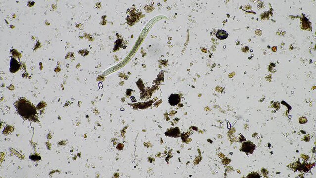 human parasite. gut intestinal infection disease. microorganism infection in hospital