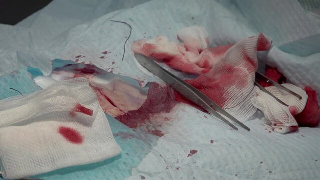 Doctor suturing wound with needle and self dissolving thread during a surgery.