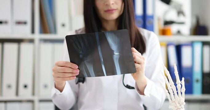 Doctor traumatologist looking at xray of hand on background of artificial model of human palm 4k movie slow motion. X ray diagnosis of rheumatoid arthritis concept