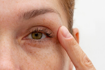 Close up cropped eye of middle aged caucasian woman looking at camera holding finger on eyelid